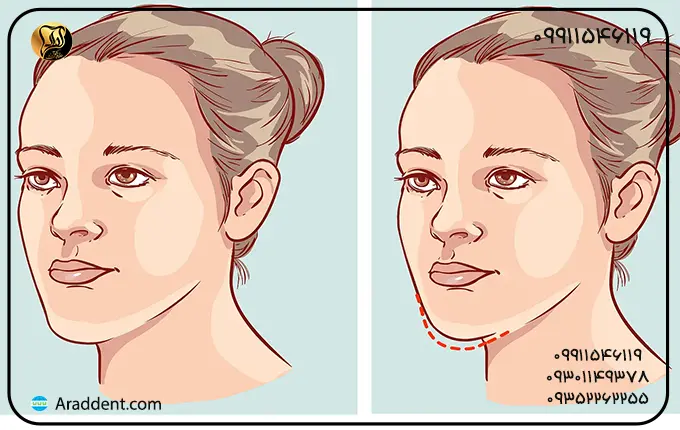 عوارض جراحی فک و صورت چیست؟