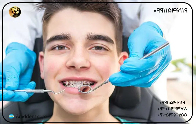 مراحل ارتودنسی دندان به ترتیب