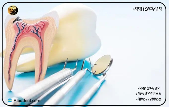 چه زمانی نیاز به درمان ریشه دندان دارید؟