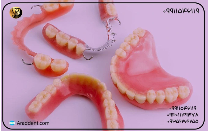 انواع پروتزهای دندانی